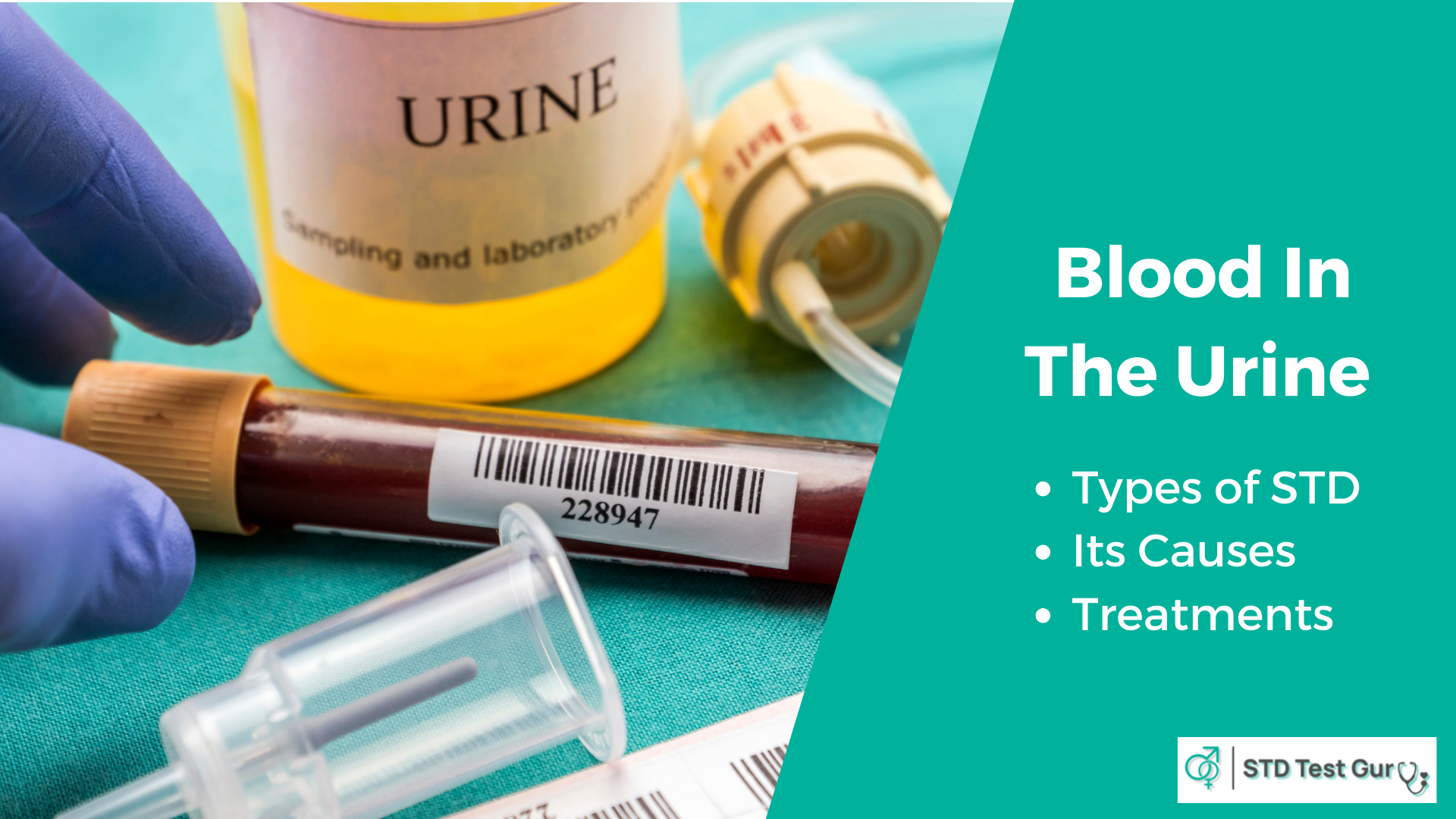 In this artice, we brief you about the causes of blood in the urine, its treatments and symptoms.